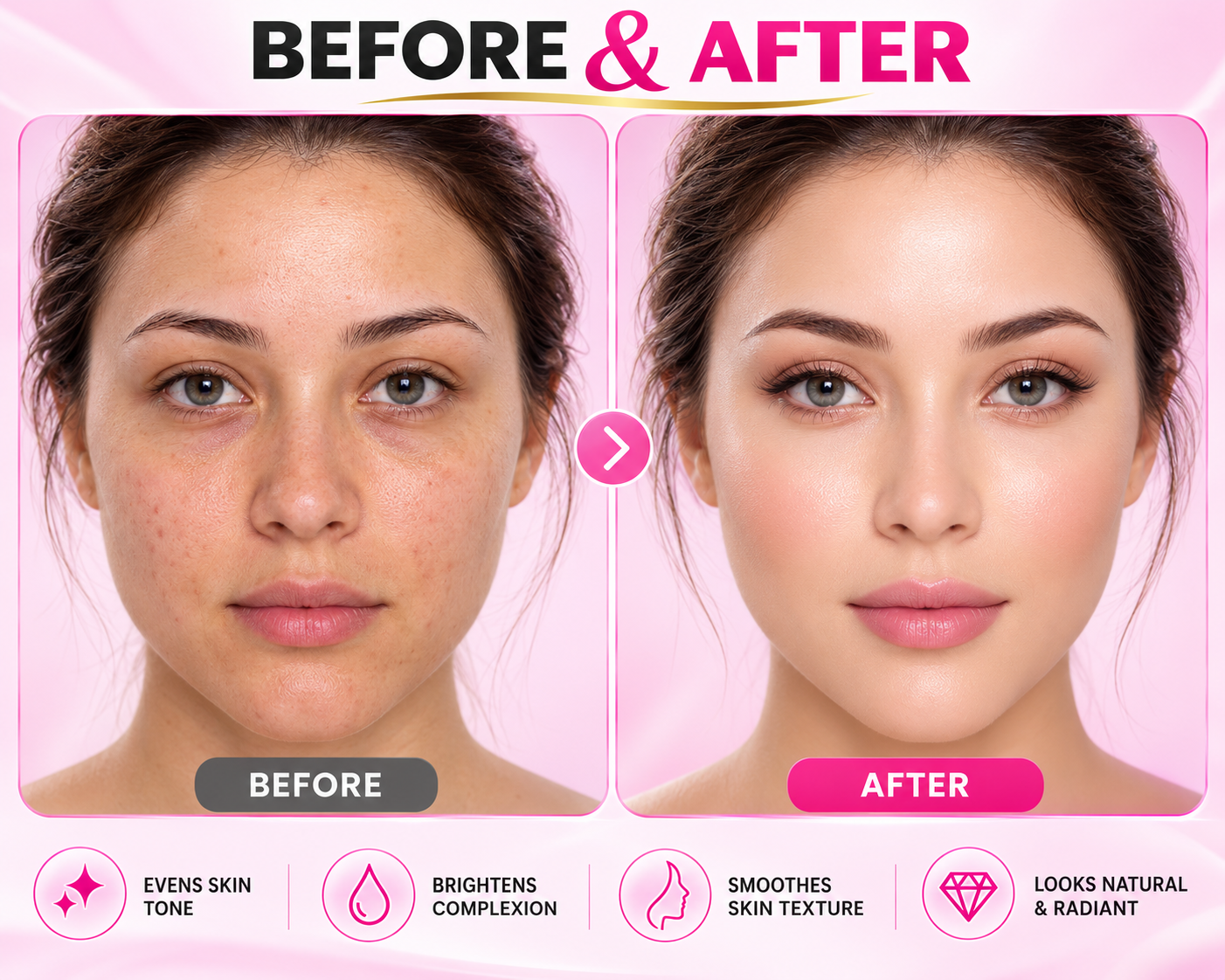 Before and After